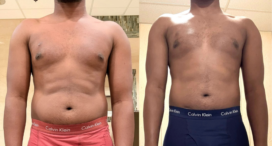 Client transformation before and after